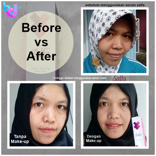 Zalfa Miracle Anti Aging Serum Zalfa Miracle Anti Aging Serum