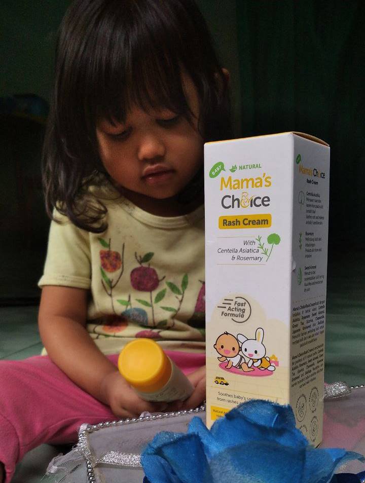 cara mengatasi biang keringat